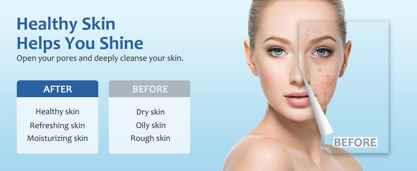 facial steamer
