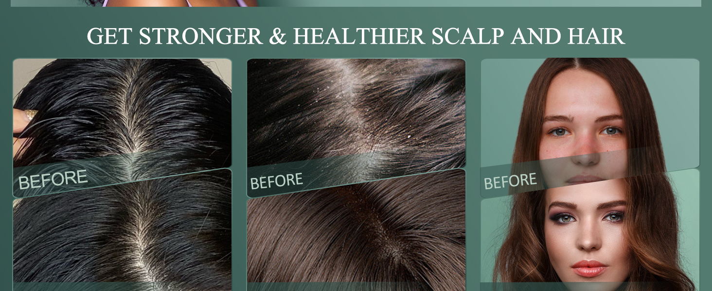 scalp scrub