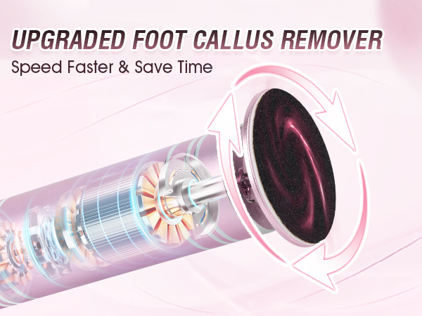 foot callus remover