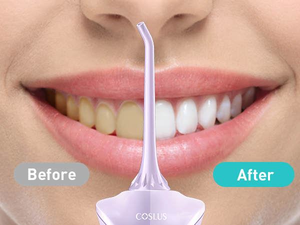 COSLUS Water Dental Flosser Pick for Teeth