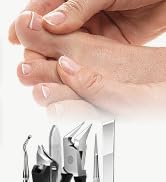 ingrown-toenail-removal-kit