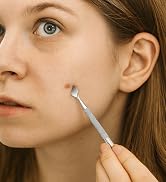 Pimple popper tool kit, acne tools, blackhead remover tools