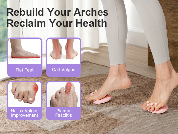 rebuild your arches