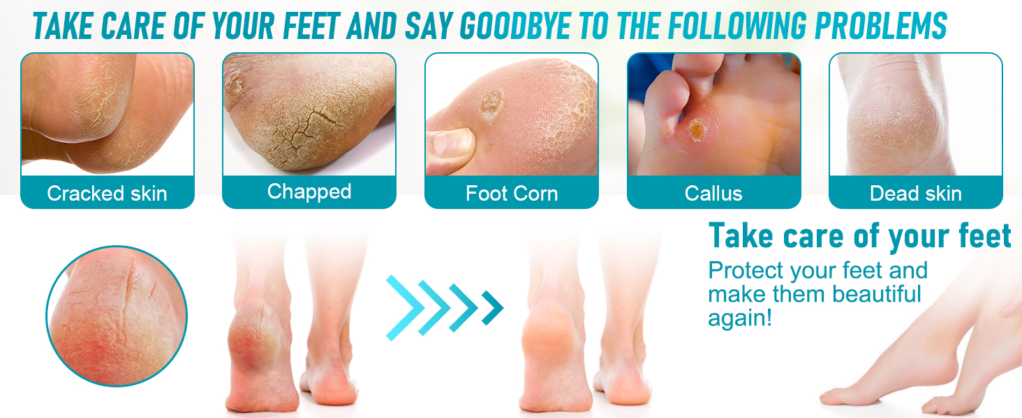 pedicure tools for feet