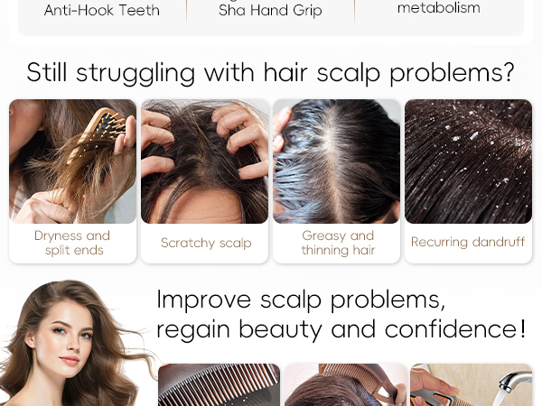 dandruff comb