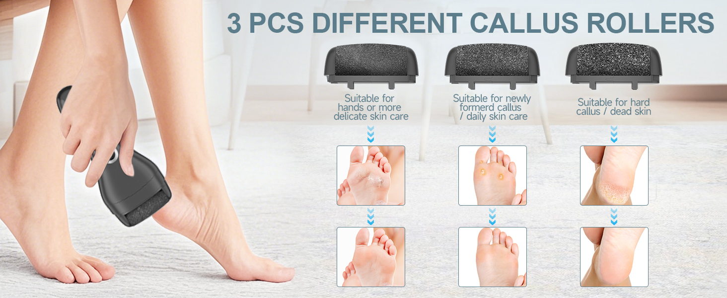 3 PCS Different Callus Rollers