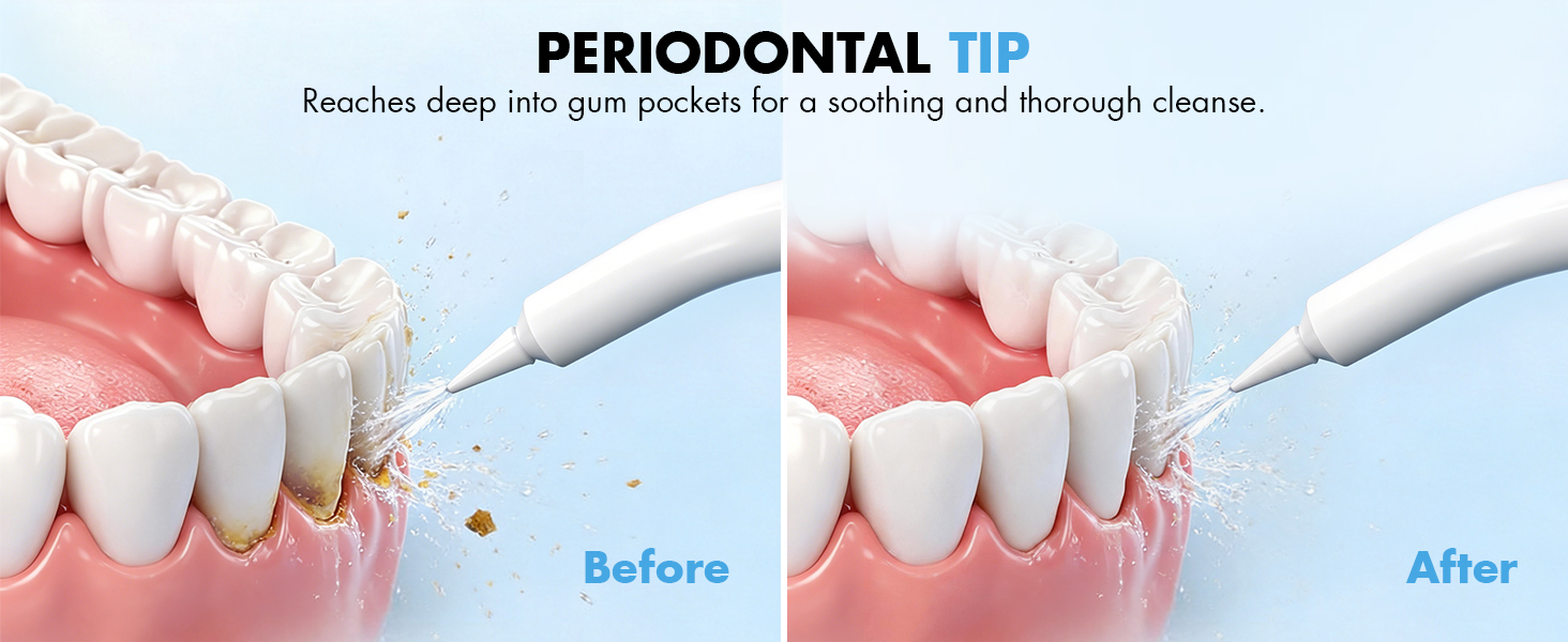electric flosser for teeth