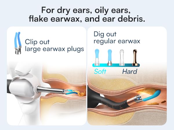 For dry ears, oily ears, flake earwax, and ear debris.