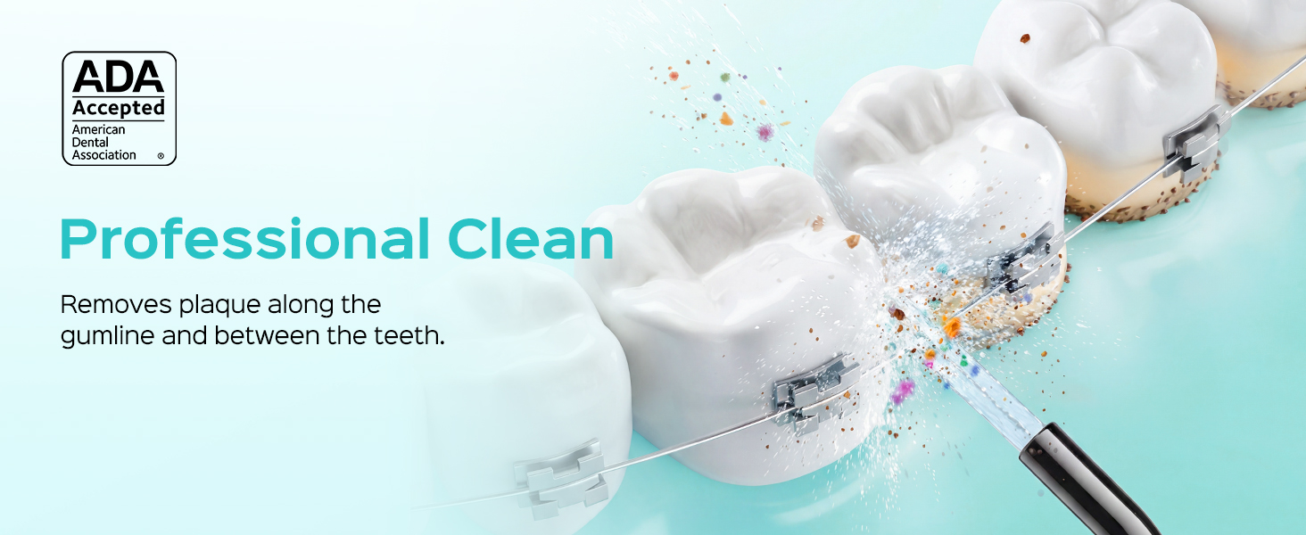 E40 water flosser 1