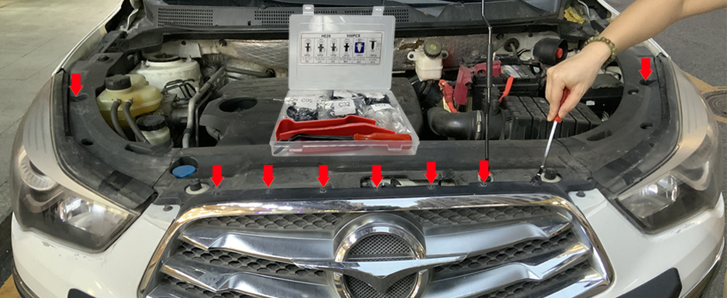 Yliebeter 105 Pcs Auto Trim Removal Tool Kit