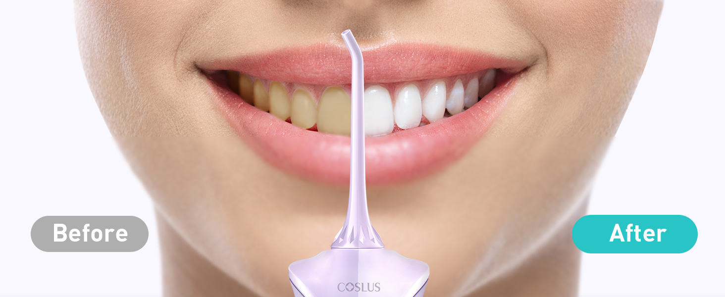 COSLUS Water Dental Flosser Pick for Teeth