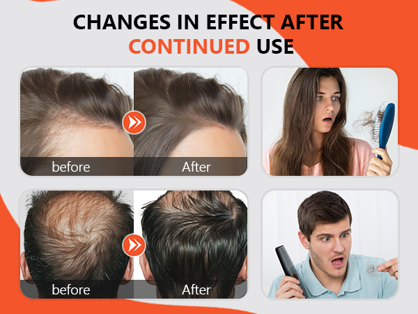red light therapy for hair
