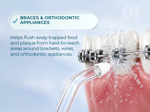 IDEAL FOR BRACES
