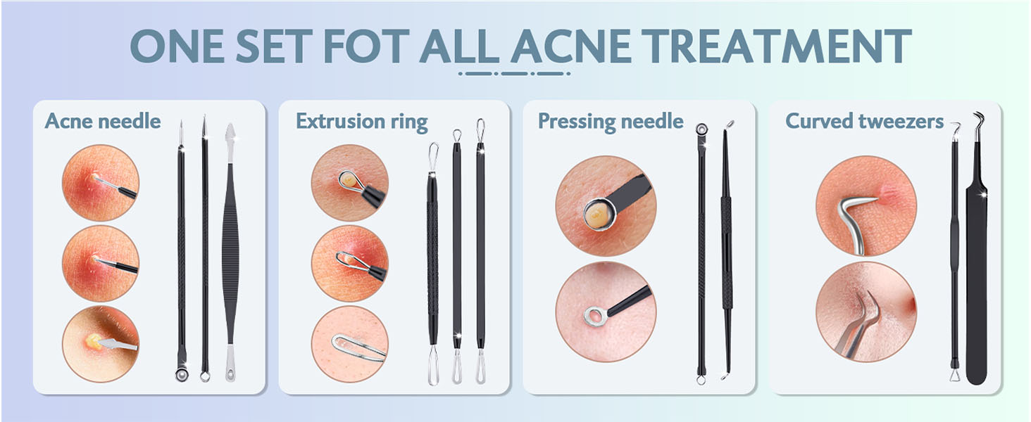 Zit Removing, Whitehead Popping and Comedone Extractor Tool with Leather Bag
