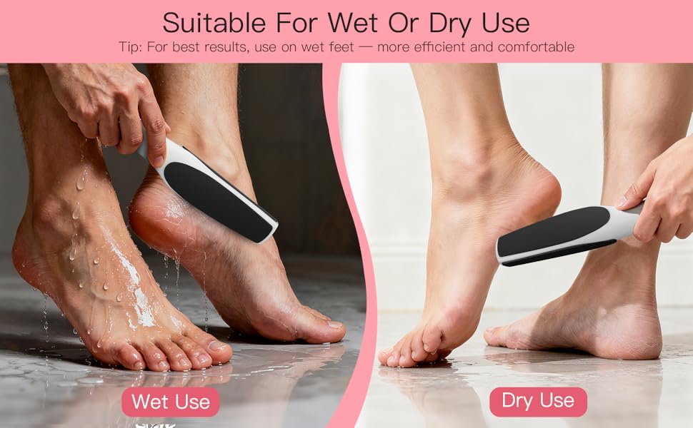 Foot Callus Remover