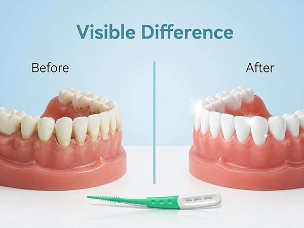 Interdental Brushes-wt