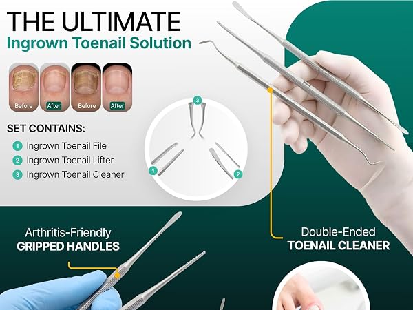 Close-up of Blizzard nail lifter tool lifting ingrown toenails and debris with precision control.