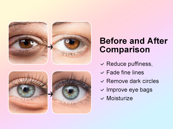 Before and After Comparison