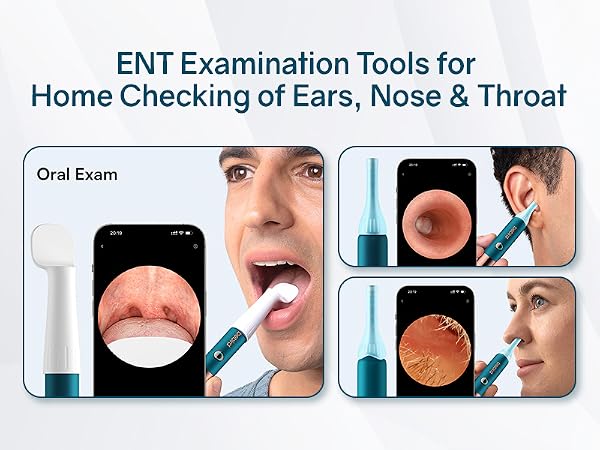 esr wax removal kit