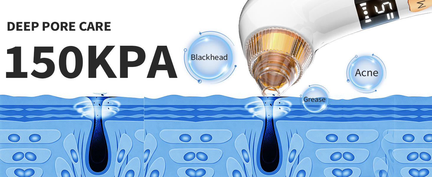 Blackhead remover