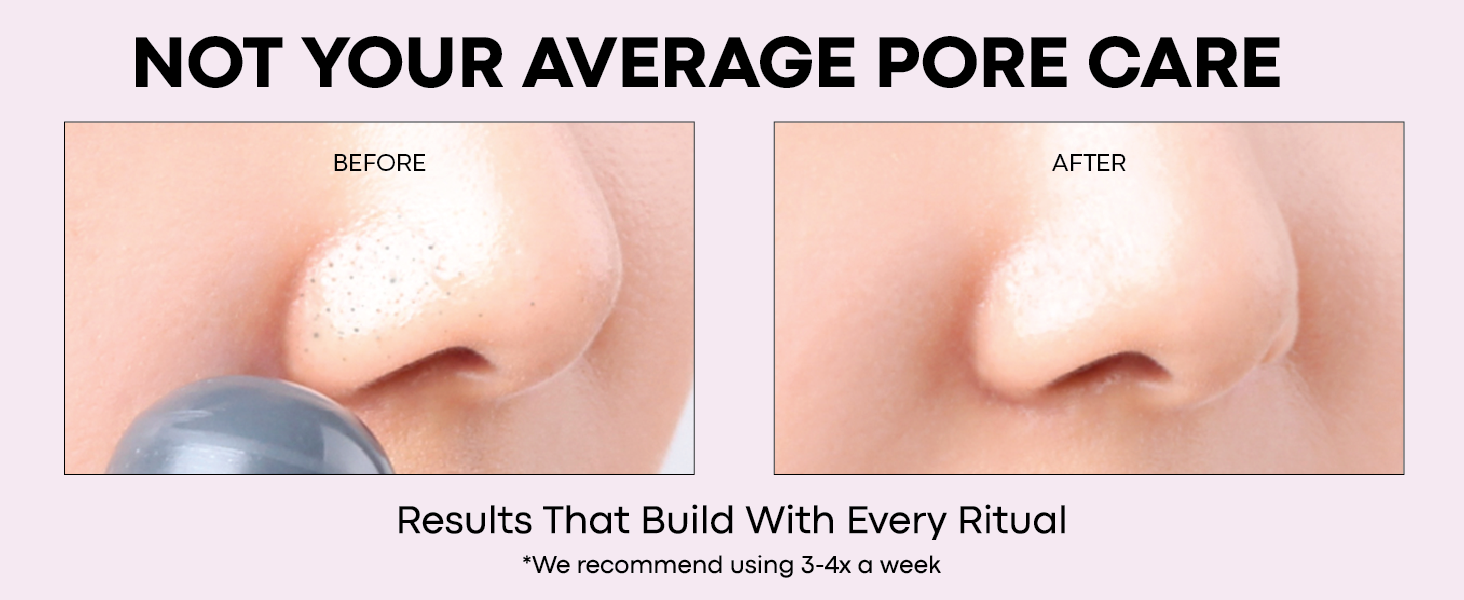 Before and after close-up showing visibly clearer, smoother pores after using Tako Scrub Stick