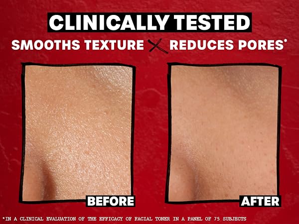 rose toner thayers