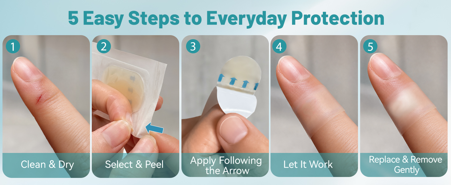 Hydrocolloid Gel Bandages