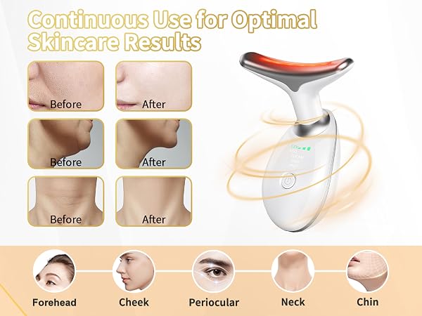 Face Light Therapy Device