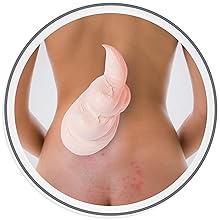 skin repair skin therapy