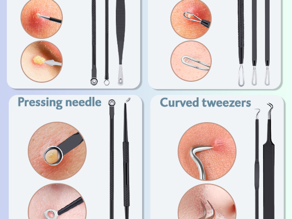 Zit Removing, Whitehead Popping and Comedone Extractor Tool with Leather Bag