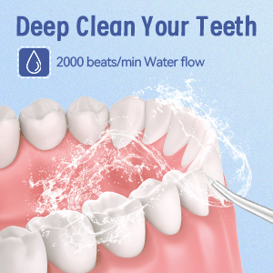 water flosser