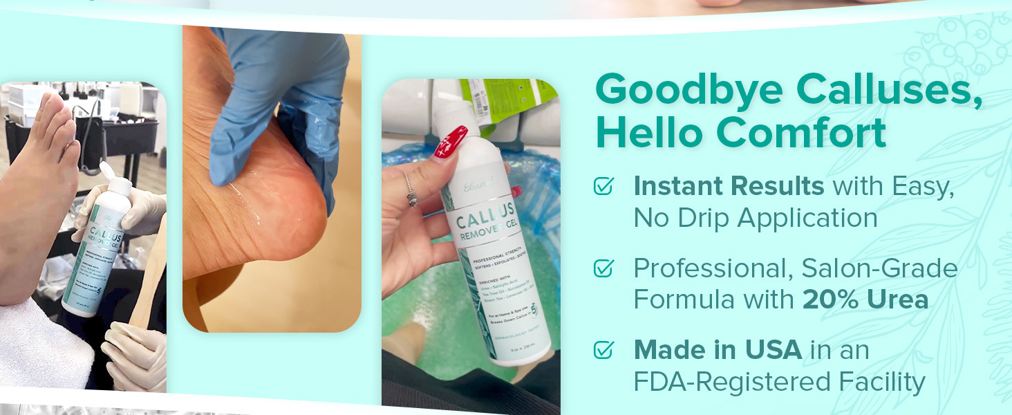 Ebanel Callus remover gel easy application professional grade formula with 20% urea made in USA