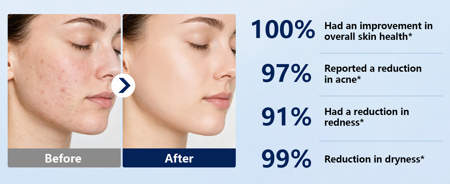 face towels disposable