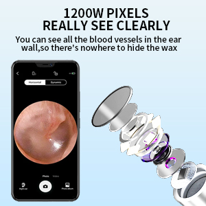 ear wax cleaner with camera
