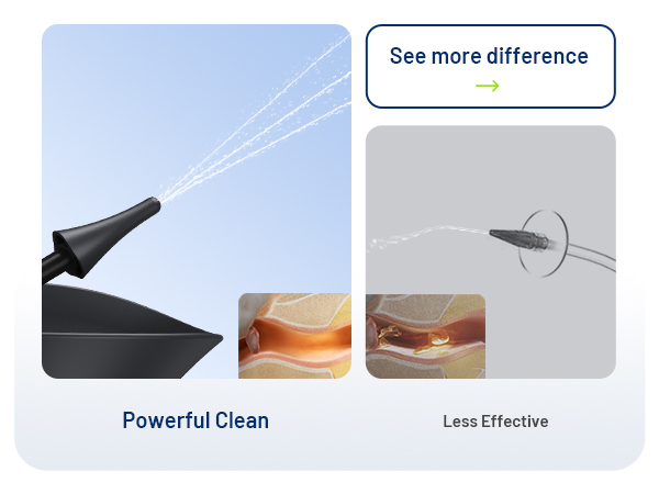 ear wax removal ear cleaner