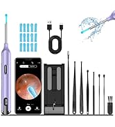 Ear Wax Removal Tool Camera, Ear Wax Camera, 1200P HD Ear Camera with 6 LED Light, Ear Cleaning K...