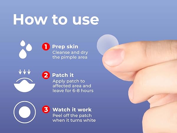 pimple patch, pimple patches, acne patches, pimple patches for face, acne treatment, acne