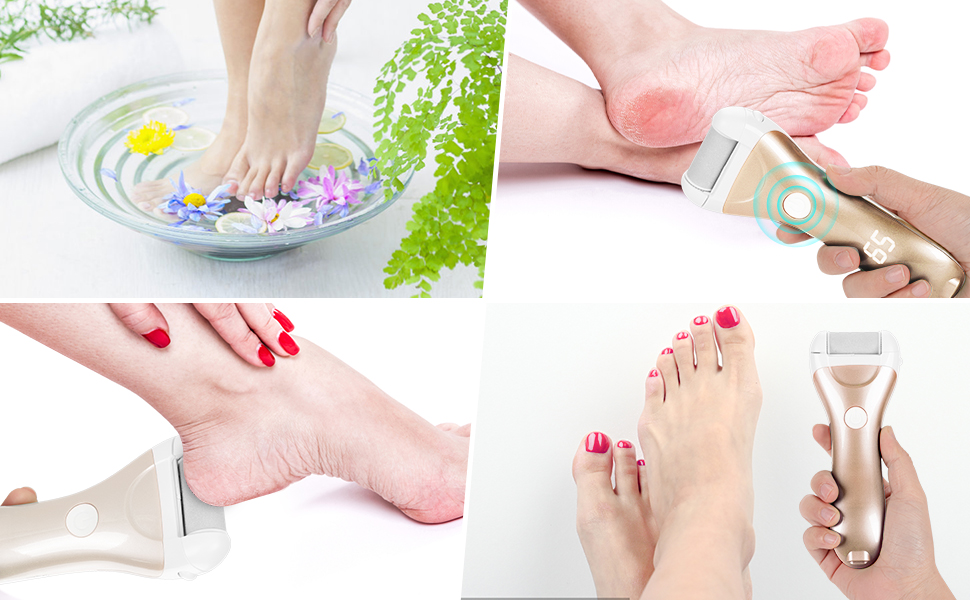 Nicebirdie professional multifunctional electric foot callus remover