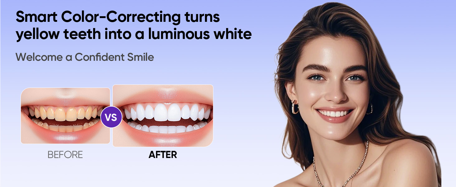 Teeth Whitening Strips