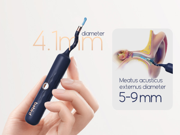 bebird ear wax removal