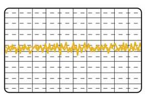 SST-ST85F-G Evolution