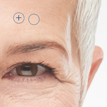 the eye area of an old lady