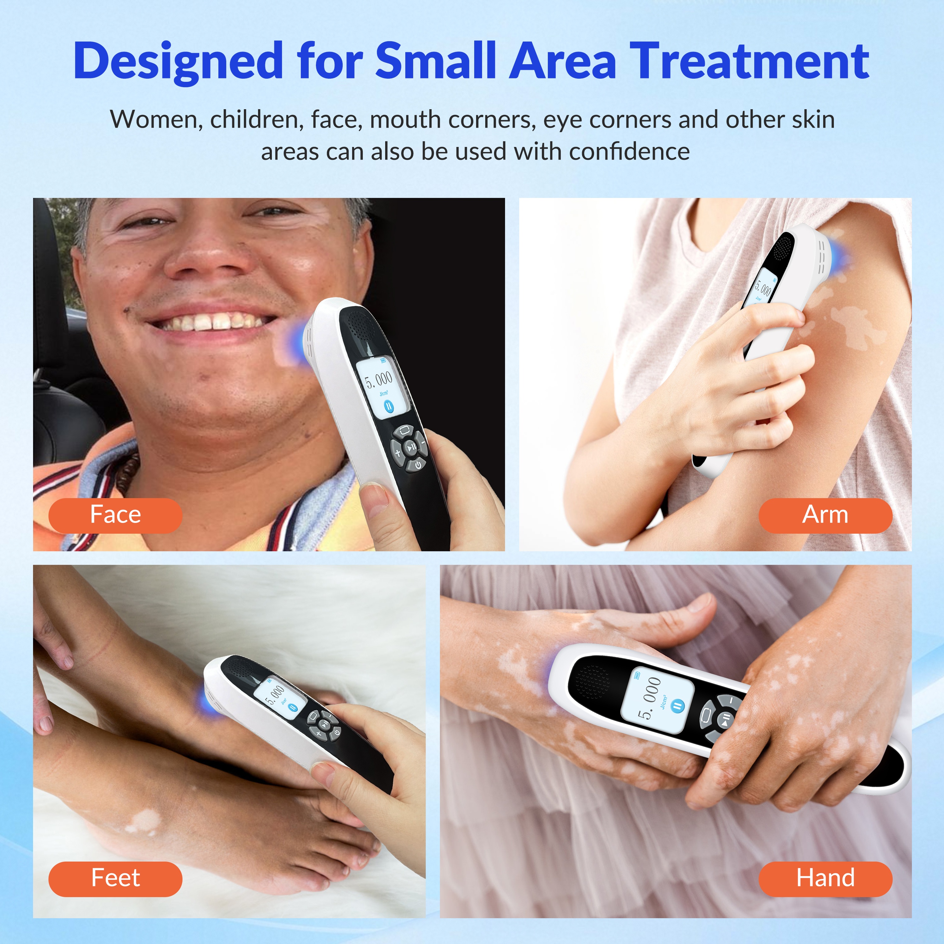 Suitable for Small Area Treatment