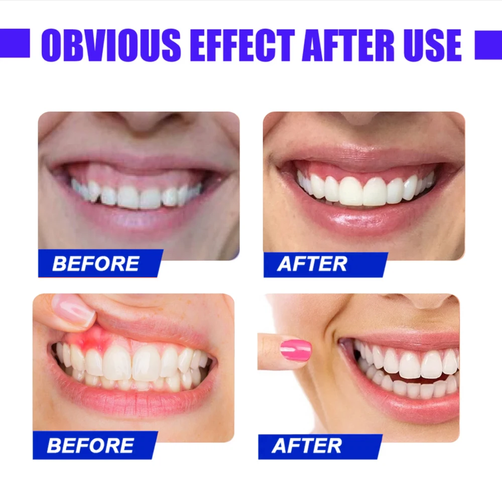 Relieve problems such as teeth issues