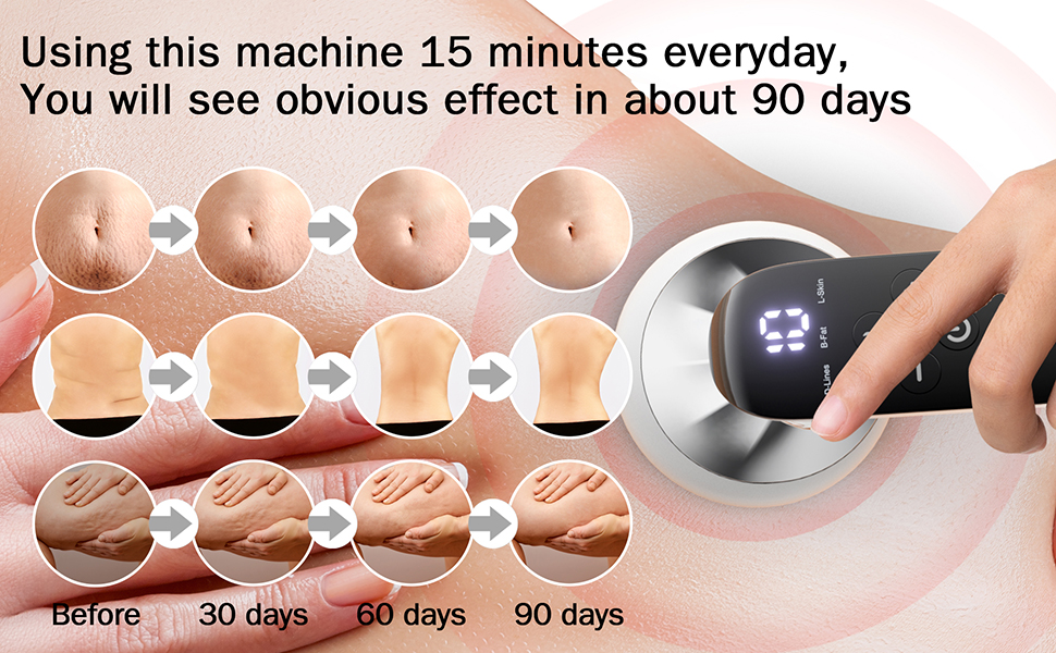 Using this machine 15 minutes everyday,you will see obvious effect in about 90 days