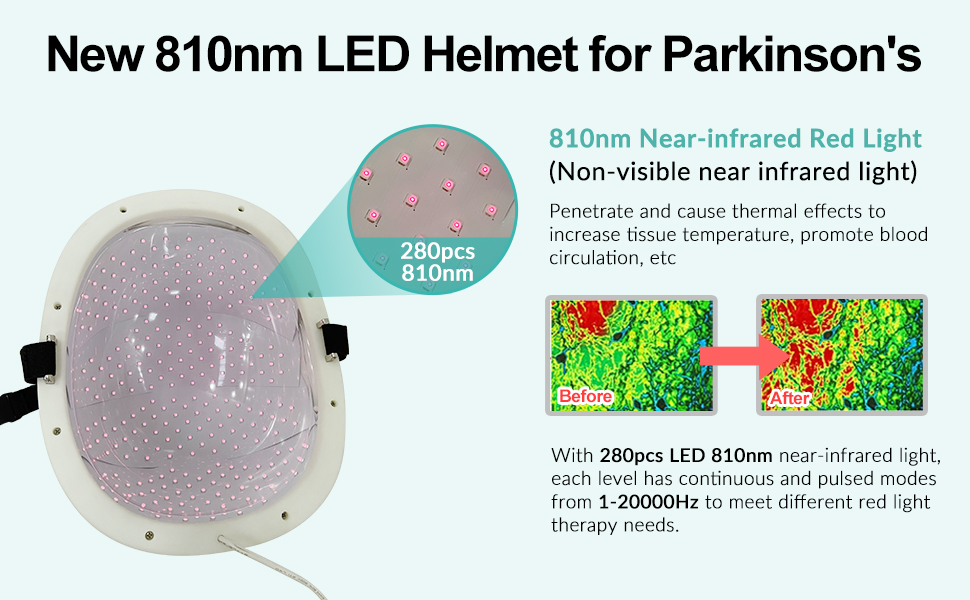 Photobiomodulation Helmet for Brain Stimulation