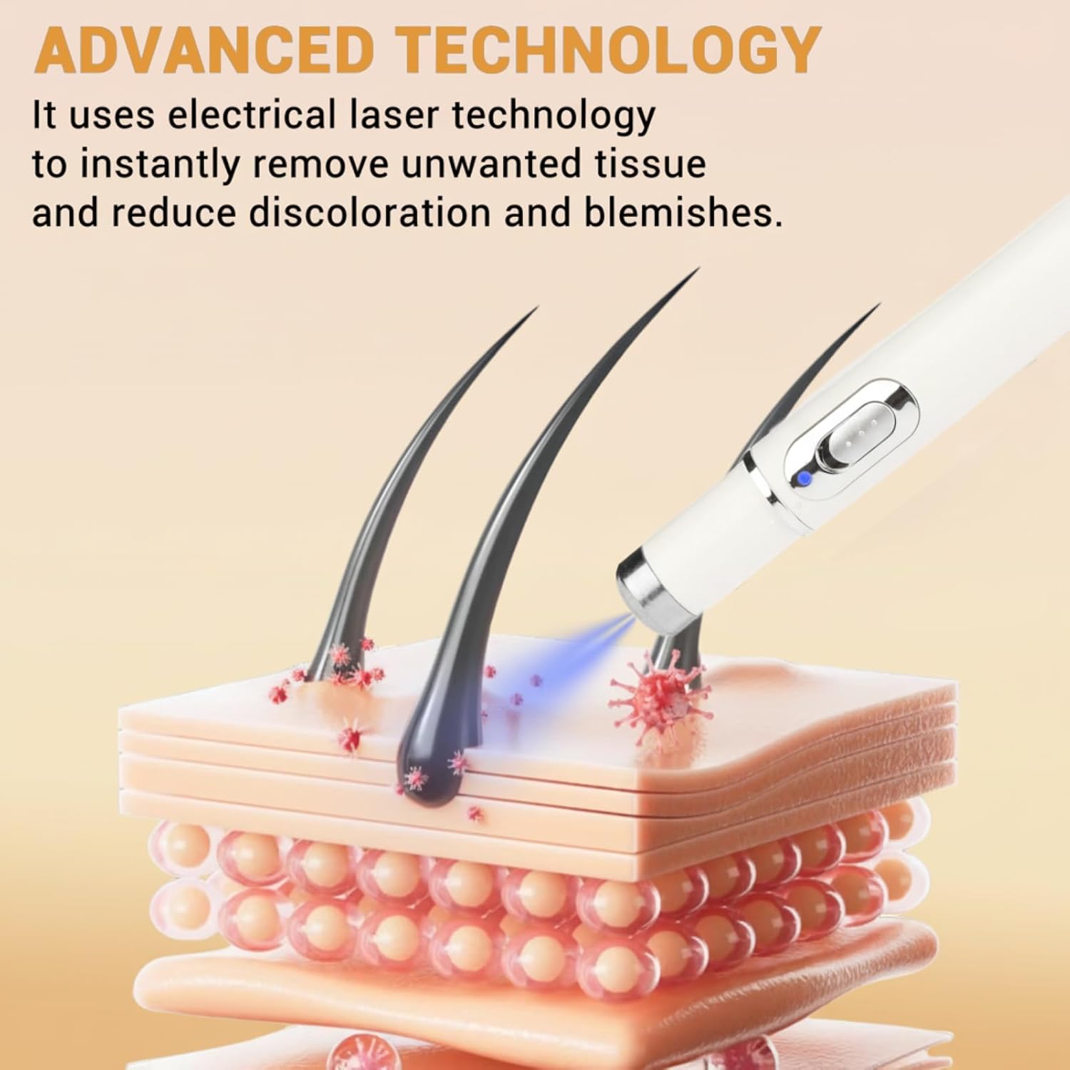 Professional Skin Tag Remover Pen