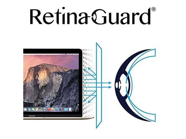 Anti UV Anti Blue Light Screen Protector for Macbook 12 Inch SGS and Intertek Tested Blocks Excessive Harmful Blue Light Reduce Eye Fatigue and Eye