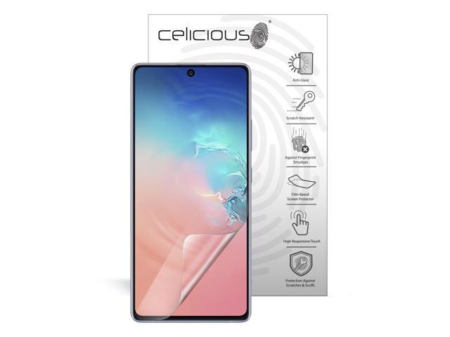 samsung s10 lite screen replacement