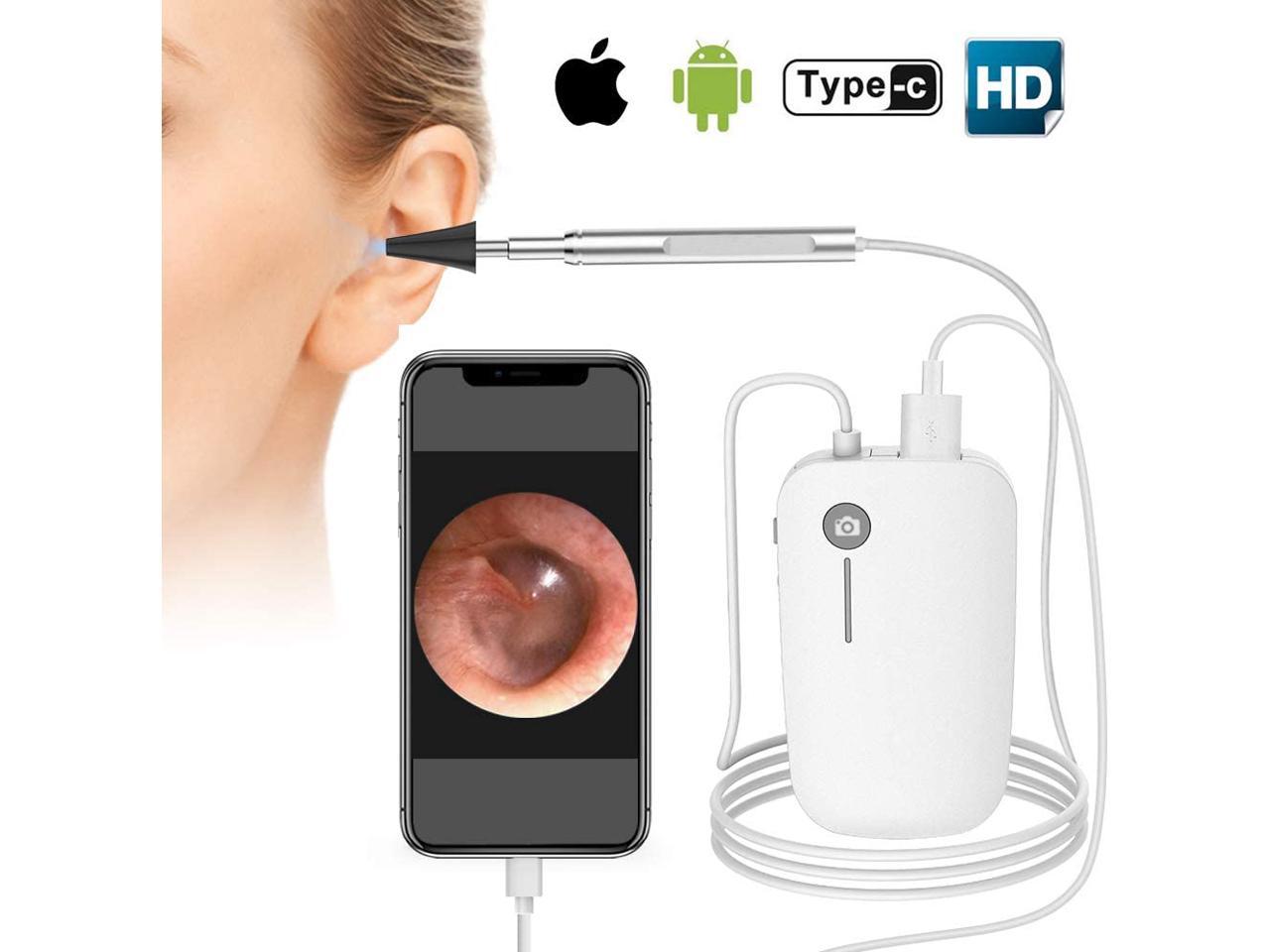 otoscope for iphone